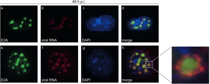 FIG 4 Ad mRNA surrounds viral replication centers. HepaRG cells were infected with wt virus (H5pg4100) at a multiplicity of infection of 10 FFU/cell