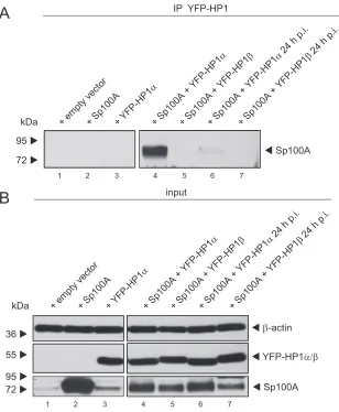 FIG 6 HP1preparation of coimmunoprecipitation (IP) samples and whole-cell extracts. Coprecipitated proteins (A) and input levels (B) of whole-cell lysates were detectedusing pAb GH3 (anti-Sp100), AC-15 (anti-� interaction with Sp100A is reduced during Ad i