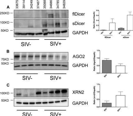FIG 4 Disruption of miRNA biogenesis during chronic SIV infection. Western blot analysis of DICER1 (A; left), AGO2 (B; left), and XRN2 (C; left) expressionin the intestinal mucosa of SIV-infected macaques (n � 4) and SIV-negative controls (n � 4)
