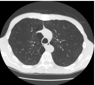 Figure  4: Median filtering image  