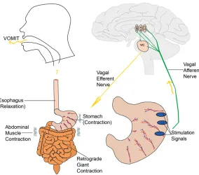 Figure 1. Activation of vagal afferents involved in the processing of vomiting.