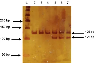 Figure 2. Genotype identification of -863 C>A poly-morphism of TNFA gene. The figure shows a 6% polyacrylamide gel
