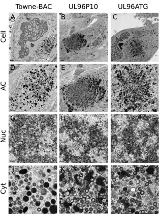 FIG 9 Impact of reengineering of the UL96ATG (171819 C-to-T) mutation in the B6-BAC genome on the infected-cell phenotype and virus morphology.Shown are representative transmission electron micrographs of HF infected with Towne-BAC (A, D, G, J), UL96P10 (B