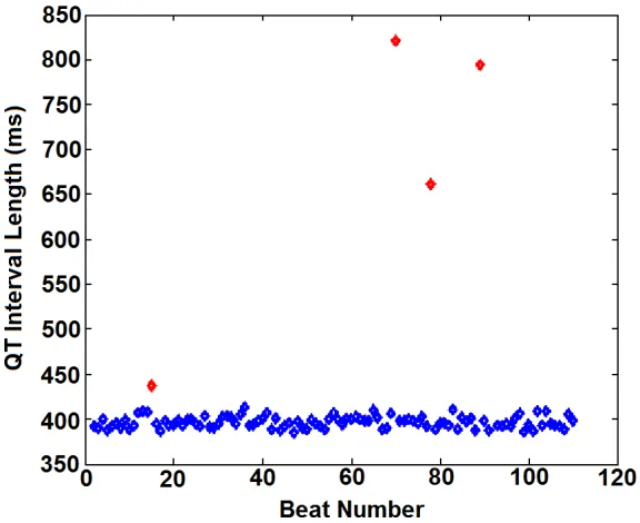 Figure 6:  Three adjacent beats before (left) and after (right) Q wave onset vertical adjustment