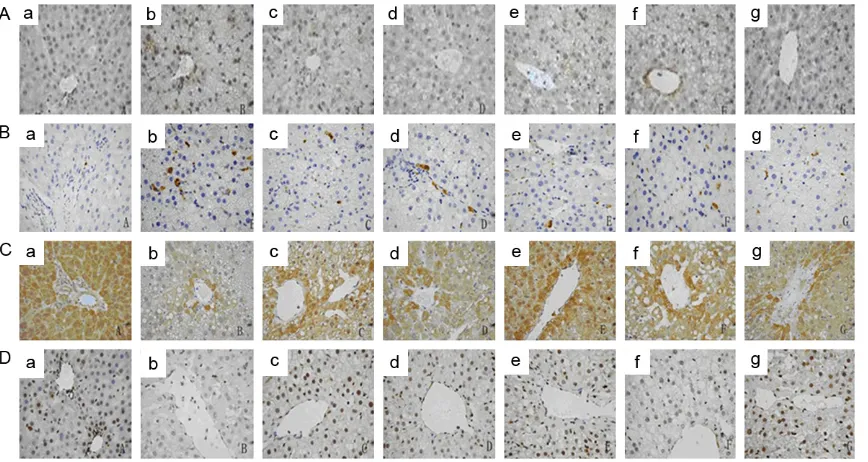 Figure 1. Effects of JTXZ on expressions of NF-κB (A), CYP2E1 (B), PPARγ (C) and ABCA1 (D) in obese rats’ liver (×40)