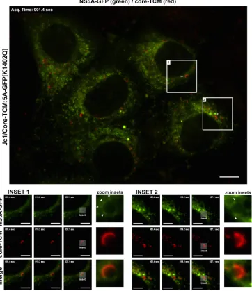 FIG 9 Live cell imaging of HCV core and NS5A proteins in the context of a productive infection