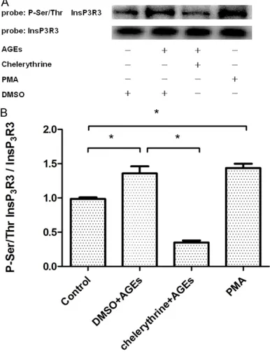 Figure 6. Protein kinase C activity increased in smooth muscle cells treated with 150 μg/mLand 200 μg/mL AGEs compared with the control group (2.36±0.07, 2.10±0.06 vs