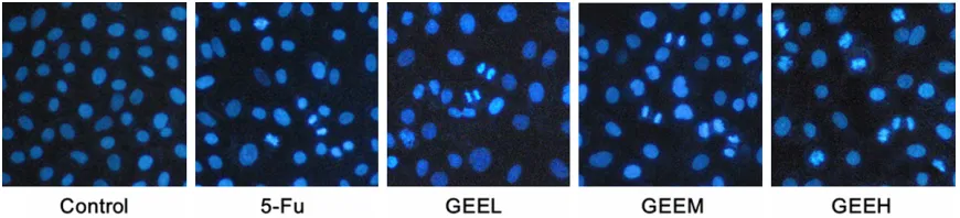 Figure 3. The effects of GEE on the morphologic change of SiHa cells (100×). Following treatment for 48 h, the  morphological changes observed in SiHa cells via inverted microscope