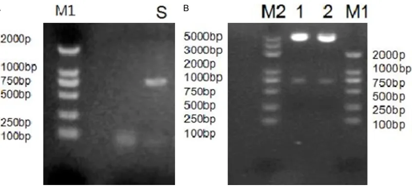 Figure 1. Electrophoresis of S gene PCR product and pcDNA3.1/HBs digested fragments. Amplification products of S gene were analyzed by agarose gel electrophoresis (A); Digestion products of pcDNA3.1/HBs were analyzed by agarose gel electrophoresis which sh