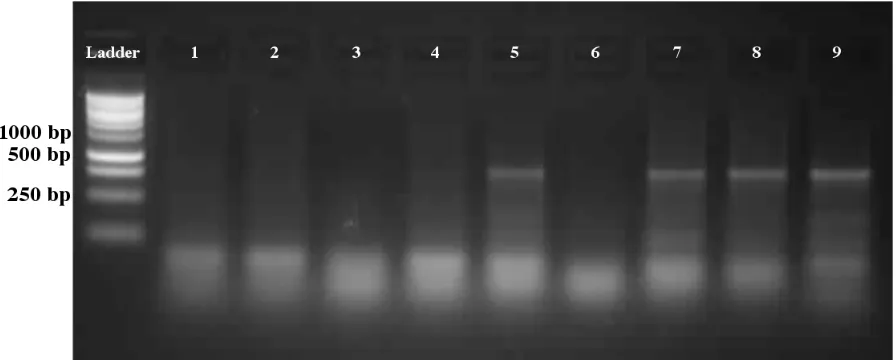 Figure 2: PCR screen for positive (pET151-lepa transformed) E. coli clones using lepa specific primers
