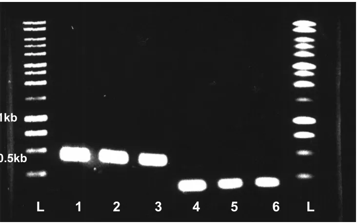 Figure. 8. PCR analysis of P. furiosus  SOR and Rd. L: DNA size standards Lane 1: P.