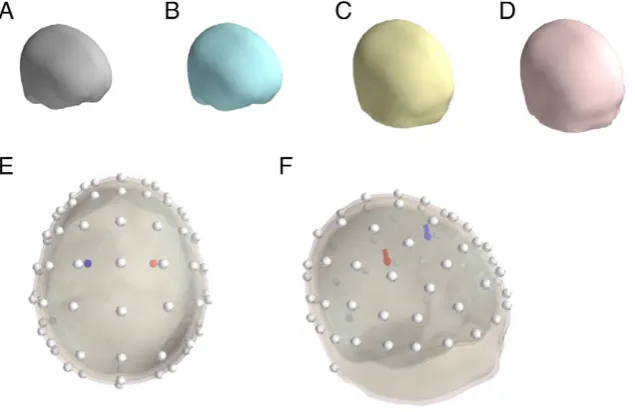 Fig. 2. Simulation model. A–D. Graphic representation of the four meshes used as interface