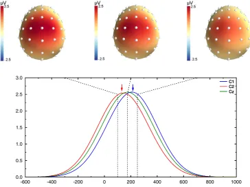 Fig. 3. Simulated potentials for the last simulation (100 ms vs. 250 ms). The upper row shows the scalp potential topographies obtained at 150, 175 and 250 ms