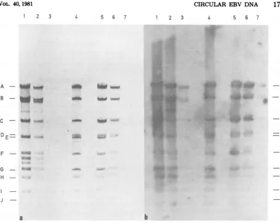 FIG. 3.2b.electrophoresiscontainscells,(lane(b) EcoRI cleavage patterns of circular EBV DNA from Raji cells and B95-8 cells, as determined by in a 0.35% agarose gel