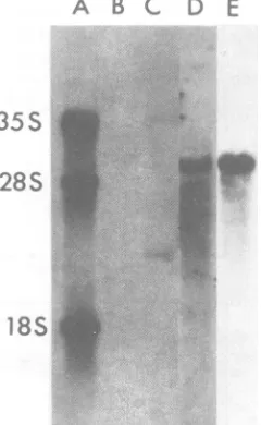 Figure 5,RNAconsistent lane E, shows that only the 29S UR1 could be hybridized with cDNAf,