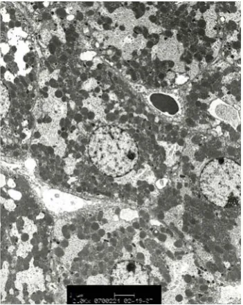 Figure 2.5. A typical TEM image of a stained mouse liver tissue section.  
