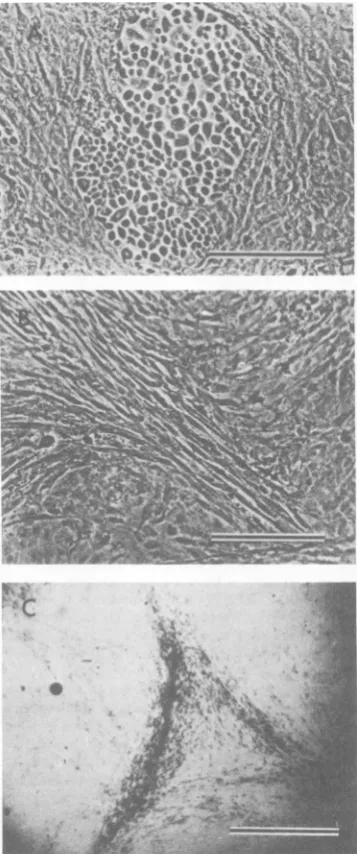 FIG.1.formedmethylenecellsURL. (A) Morphology of cells transformed by Bar = 100 tm. (B) Morphology of cells trans- by UR2