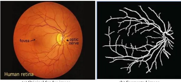 Figure 1: Blood vessel segmentation 