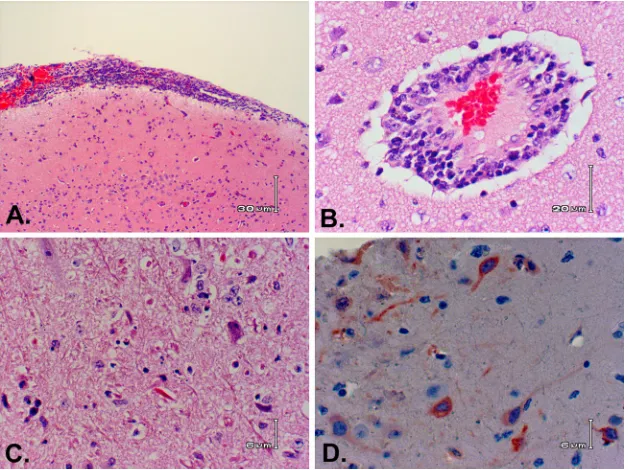 TABLE 3 Viral load in tissues from NHP that succumbed after exposureto aerosolized RVFVa