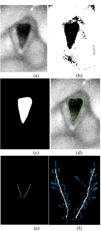 Figure 4: Demonstration of methodology with a sample image frame of normal vocal cords: (a) Pre-processed image (b) Image thresholded using non-linear thresholding (c) Result after morphological operations on image b (d) Segmented glottal area by applying 