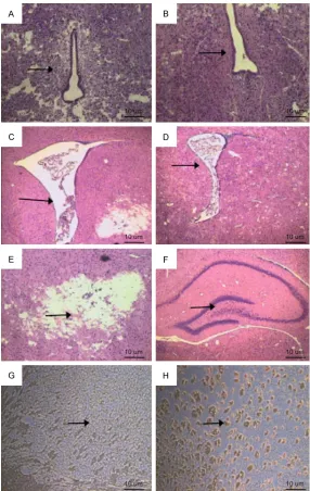 Figure 5. Pathology in rat brain tissue. A. Periventricular leukoaraiosis is seen in the experimental group at 24 h after surgery