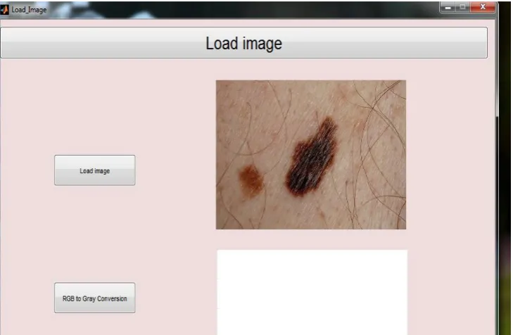 Figure 5.1: Loading original image. For classification of skin lesion, an input image is required