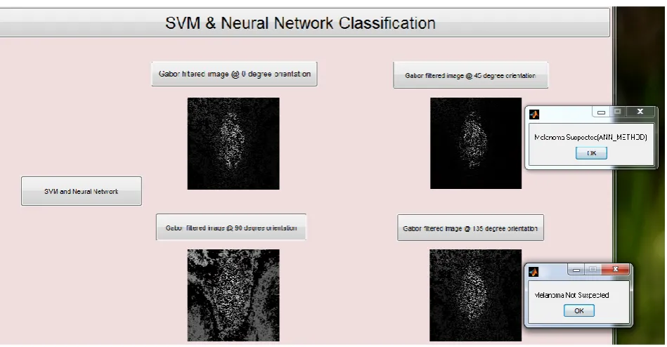 Figure 5.6: Melanoma suspected using SVM and not suspected using neural network. The input image  is a skin lesion