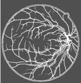 Fig 7 : Final Segmented Image 