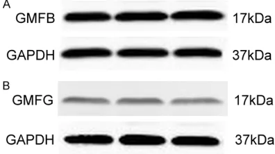 Figure 1. The expression of GMFB and GMFG in as-trocytes. A: The detection of GMFB in SD rat astro-cytes by Western blotting