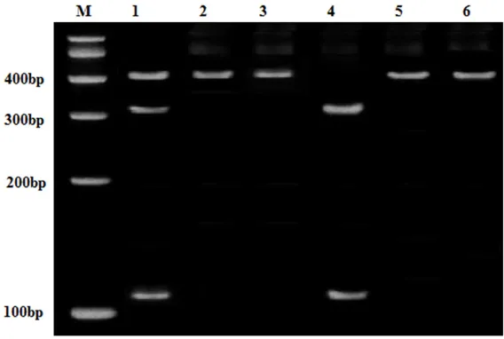 Figure 1. Agarose gel electrophoresis images for COL1A2 rs42524. 1 lane: GC genotype; 2, 3 and 6 lanes: CC genotype; 4 and 5 lane: GG genotype.