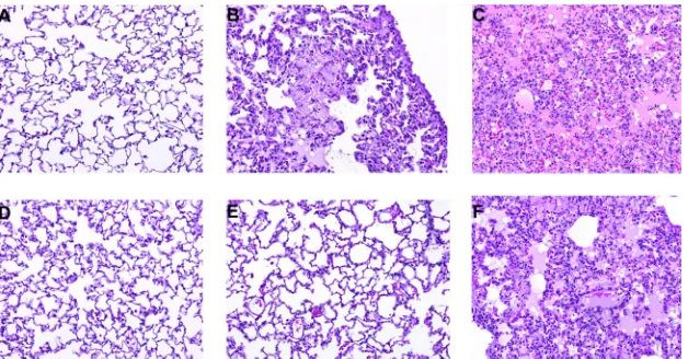 FIG 4 Dexamethasone/cyclophosphamide immunosuppression of SNV-infected hamsters creates lung pathology similar to that of ANDV-infected hamsters.H&E staining of lungs collected on day 10 from hamsters infected with SNV and treated with dexamethasone (A), c