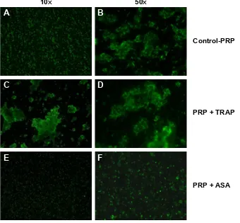 Figure 4 Immunofluorescence microscopy. Effects of TRAP and ASA on platelet aggregation