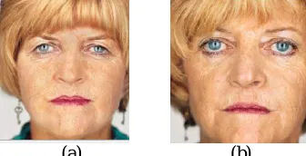 Fig.4 (a) and (b) is the pair of extracted twins’ images. 