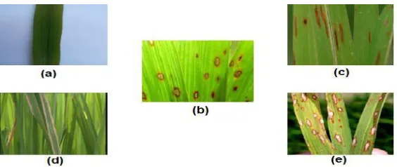 Figure 1 RGB image of normal leaf (a), (b)-(e) diseased leaves of brown spot, narrow brown spot, 