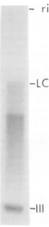 FIG.10.formnedforMethods.DNAIIIdigested BglI digestion of the products of in vitro synthesis