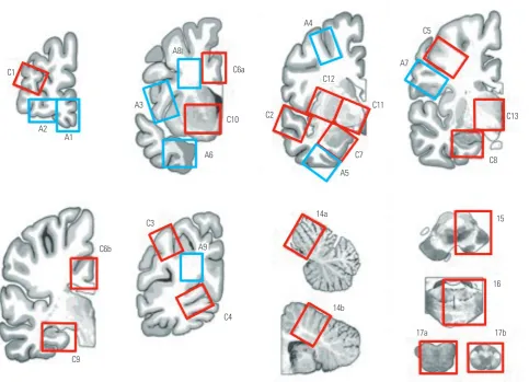Fig. 1. Illustration showing where to collect the core and additional blocks listed in Table 1.