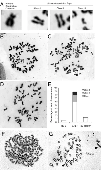 FIG 4 LT attenuates sister chromatid cohesion. (A) Representative images of normal primary constriction cohesion and various classes of primary cohesiongaps: PCGI (mild), PCGII (moderate), and PCGIII (severe)