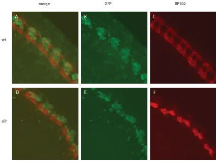 Figure 2.2 Defects of CNS axons and midline cells in slit mutants 