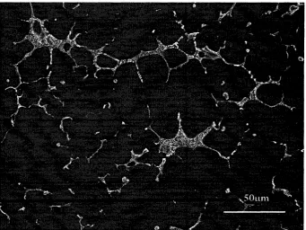 Figure 4.13: No shrinkage porosities in samples cast under 30MPa.