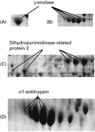 Figure 3Partial 2D gel images showing examples of proteinsThe protein is represented by one spot when IEF was performedon pH 3was performed on pH 4represented by multiple spots