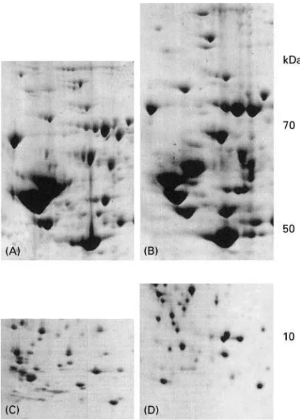 Figure 4Partial 2D gel images showing an improved spot res-olution by using different acrylamide concentrations