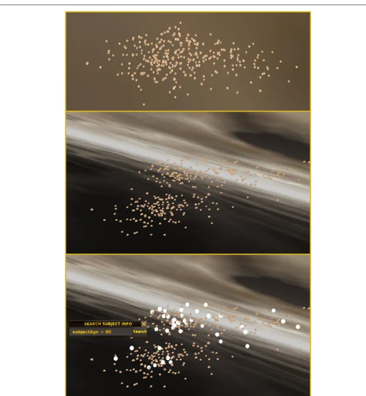 FIGURE 5 | Query-based navigation across multiple studies contained in an archive. (Top) Certain views of the cloud of brain surfaces in INVIZIAN might not reveal any particular pattern