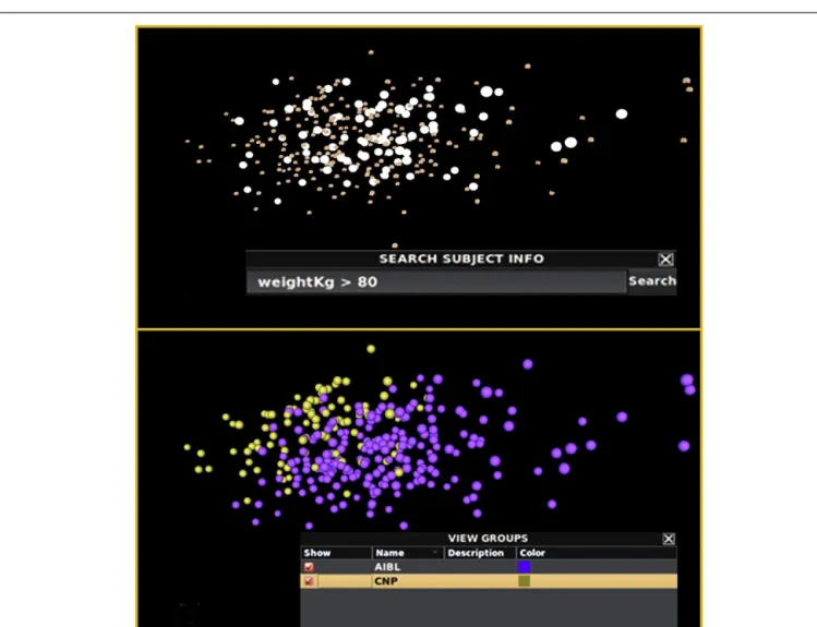 FIGURE 4 | Query-driven heterogeneous cluster discovery. (Top) Conducting a search by subject weight does not reveal any particularly interesting clustering of the brain surfaces within INVIZIAN