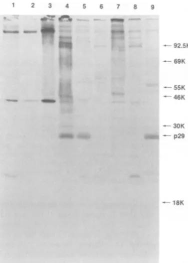 FIG. 2.gag3Lanemethionineandrum.antiserum;text.virus x Immunoprecipitation of rat type C virus precursor