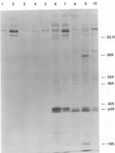 FIG. 6.2ratoninetamedformedratSD-Ilaneserum.RaSV)10%beforeby(FREtransformedeed).Fig.(Rasheed); and NQ Immunoprecipitation of cell extracts ob- from cells transformed by separate isolates of sarcoma virus