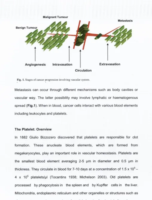 Fig. 1. Stages of cancer progression involving vascular system.