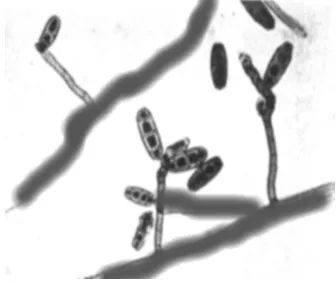 Figure 3-9.  Microscopic morphology of  Curvularia species. 