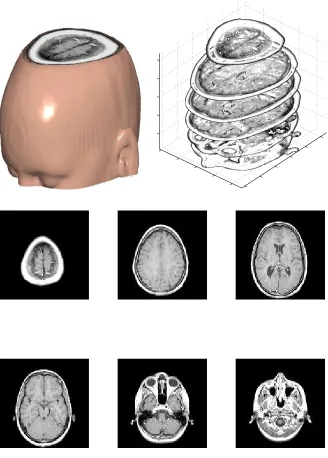 Figure 2.8: Volumetric surface.
