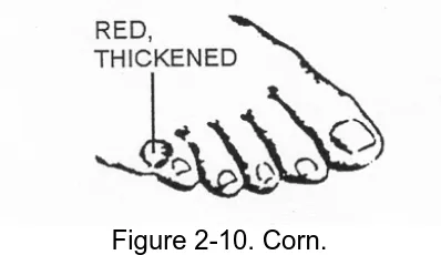 Figure 2-10. Corn.  