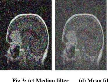 Fig 2: (a) Input image      (b) Noisy image 